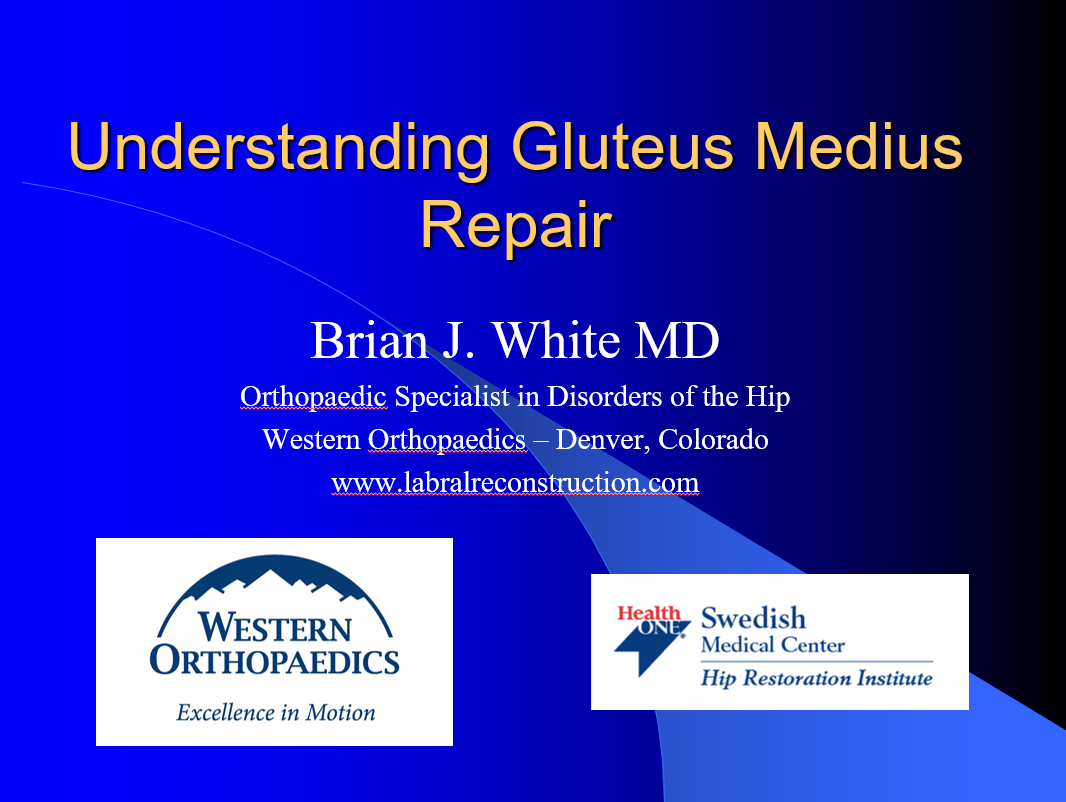 A Patient's Guide to Gluteus Medius Repair