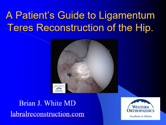 A Patient's Guide to Legementum Teres Reconstruction