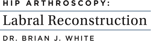 Hip Arthroscopy: Labral Reconstruction Dr. Brian J. White